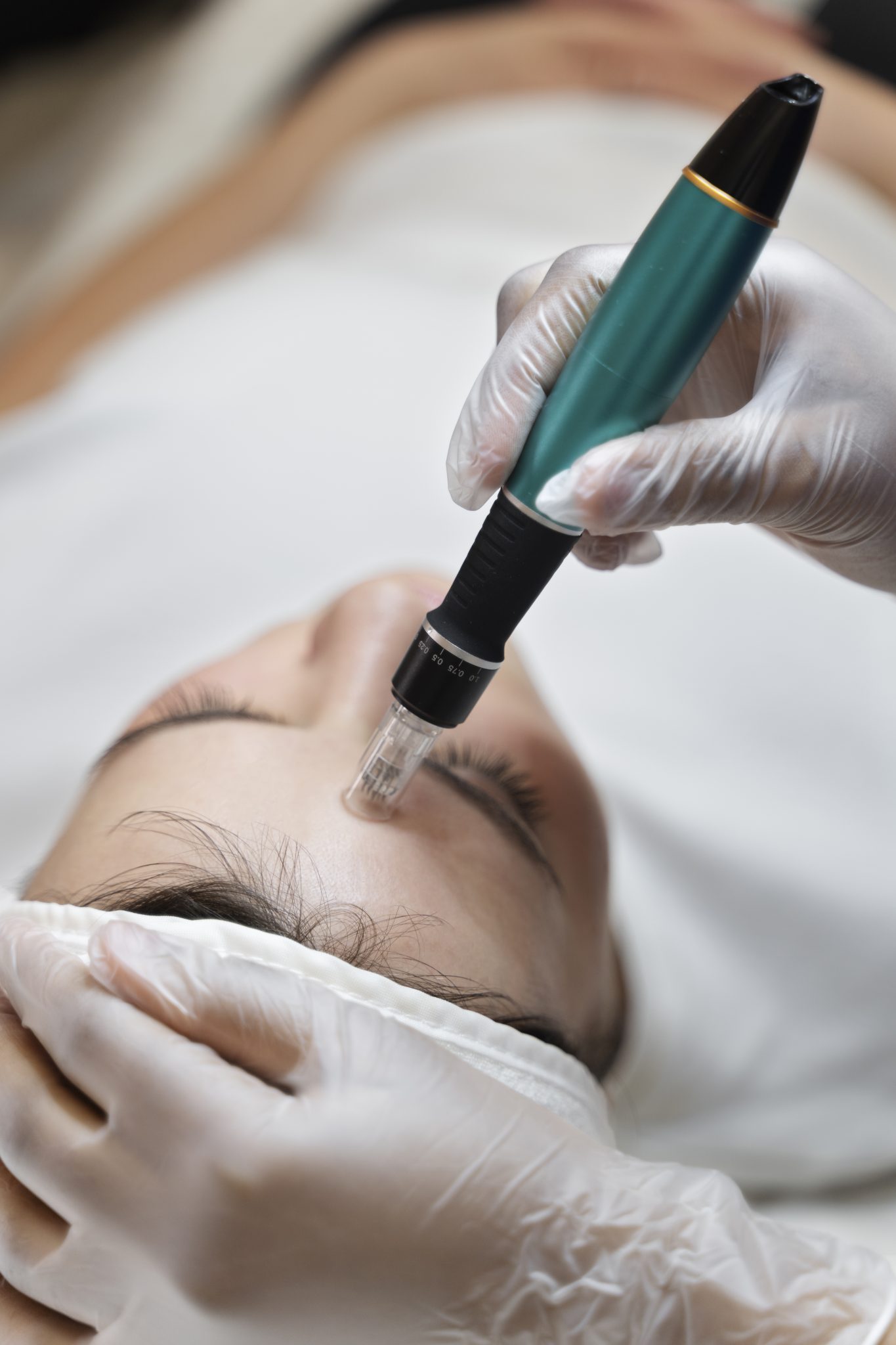 Close-up of SkinPen microneedling procedure being performed at PUR Skin Clinic to stimulate collagen and improve skin texture
