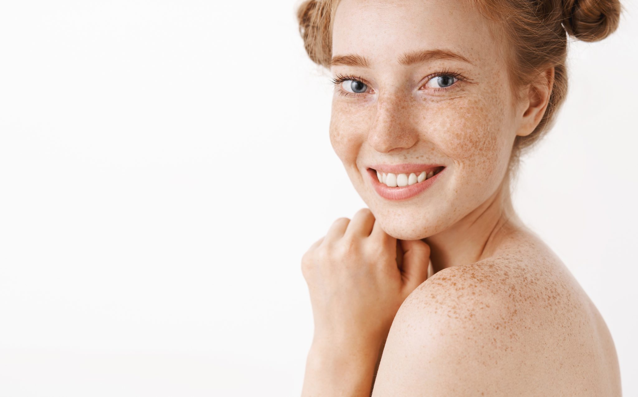 Smiling young woman with freckles and bright, even complexion after melasma treatment at PUR Skin Clinic